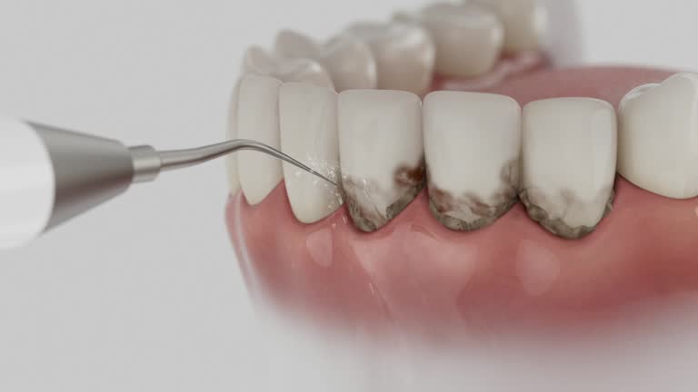 Trusted Teeth Cleaning And Checkup service in Winnsboro, TX - Dentist Open Now